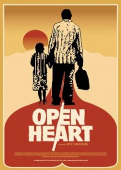 Open Heart